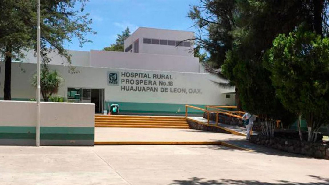 cambian-en-el-imss-cuerpo-de-bebe-por-una-pierna